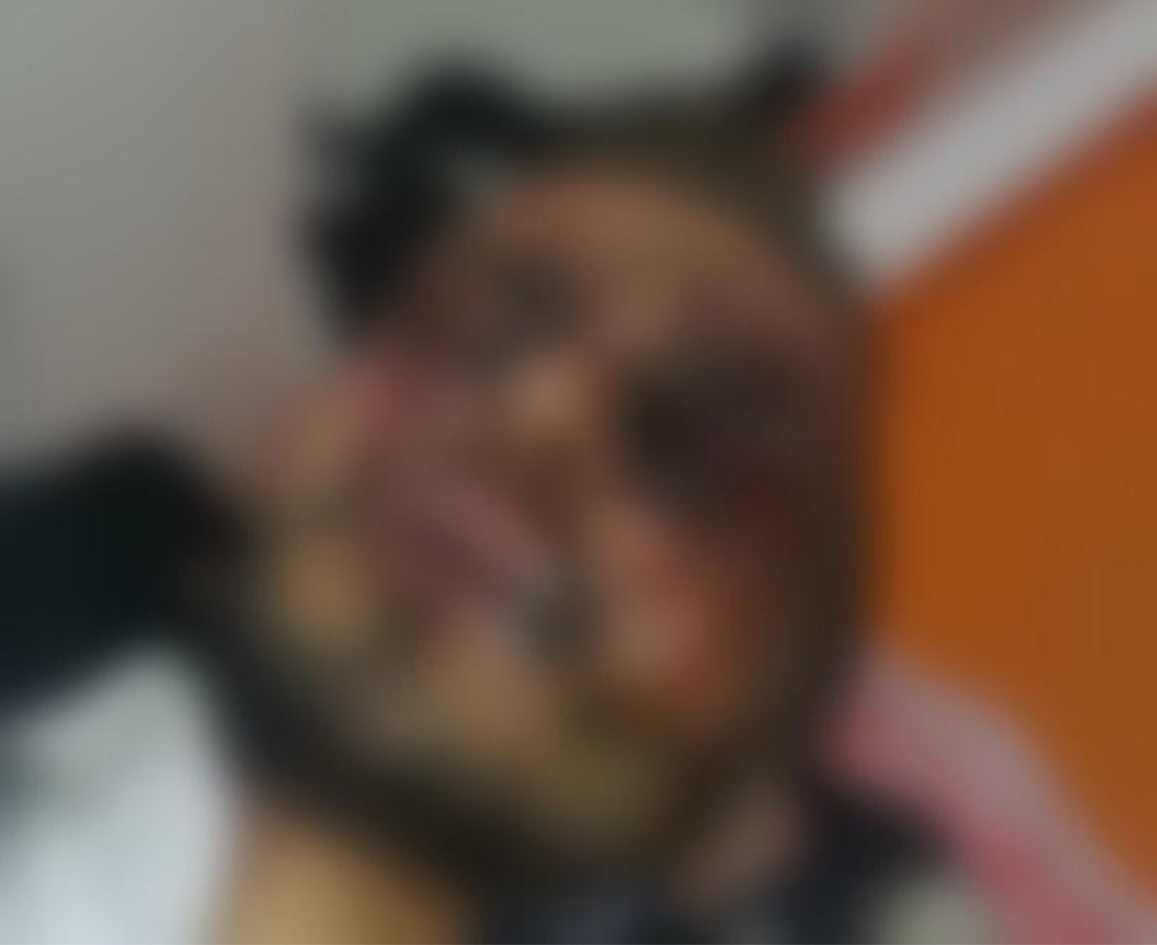 عومەر عەبدلاوی دوای سووتانی