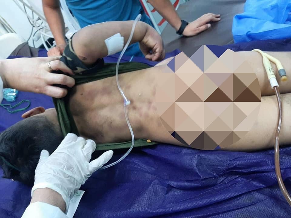 منداڵەکە دوای ئەشکەنجەدانی لەلایەن باوکیەوە