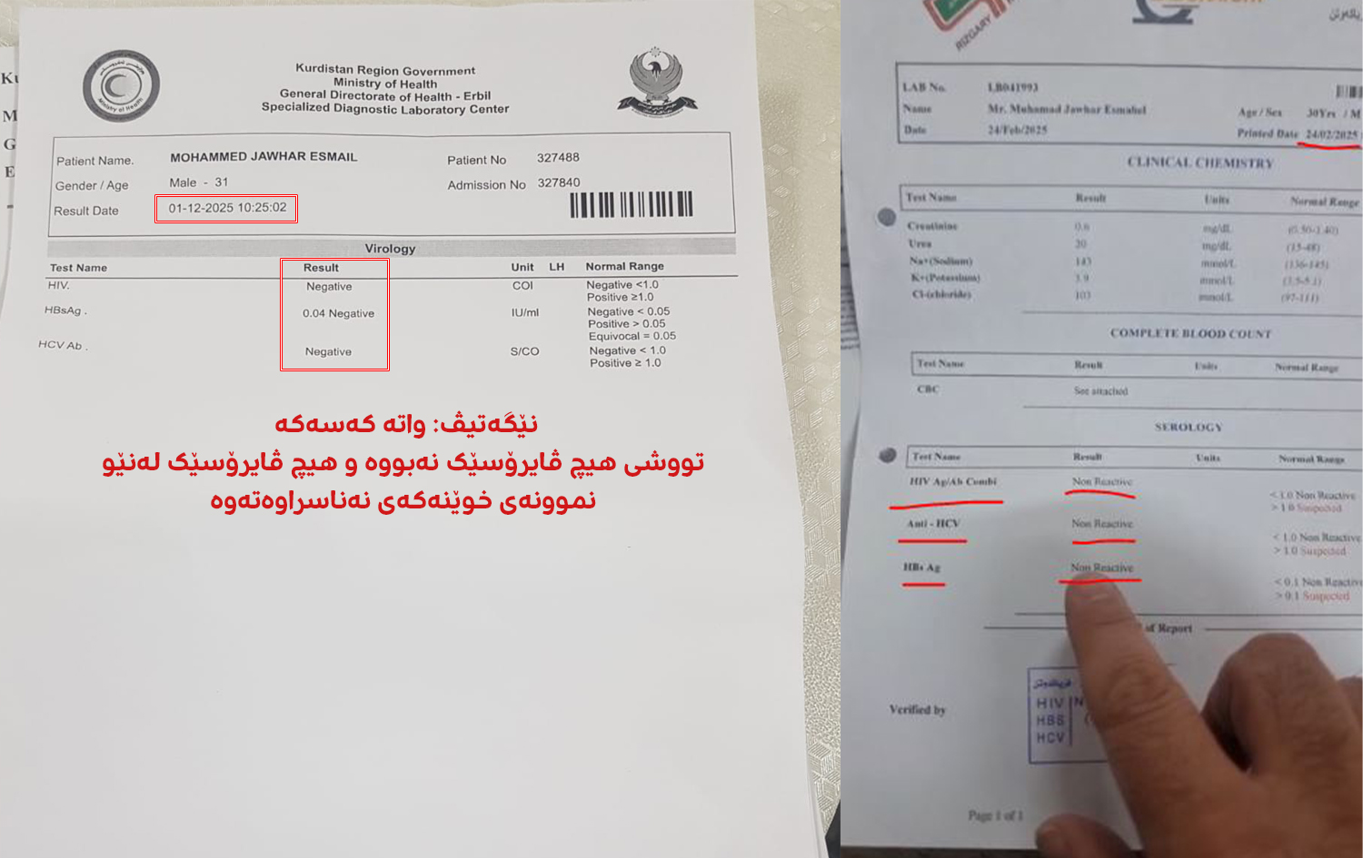 ئەنجامەکان دیارن کە محەممەد جەوهەر تووشی هیچ ڤایرۆسێکی جگەر نەبووە