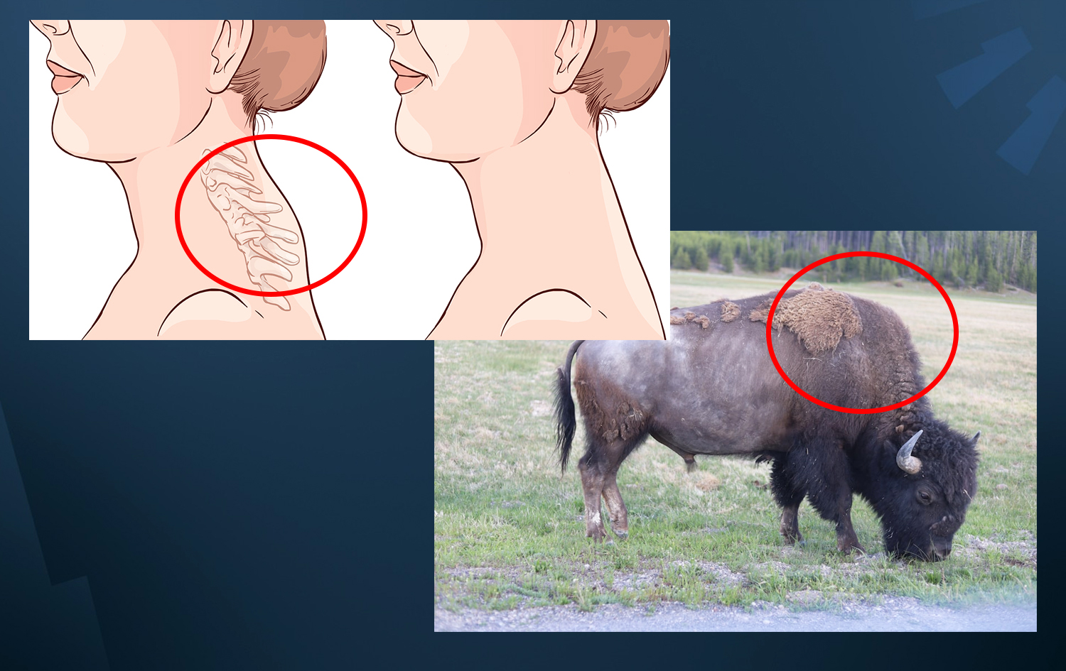 ئاماژەیەک بۆ روونکردنەوەی ئەوەی کە ئەو کێشەیە بە پشتەملی گامێش چوێندراوە.