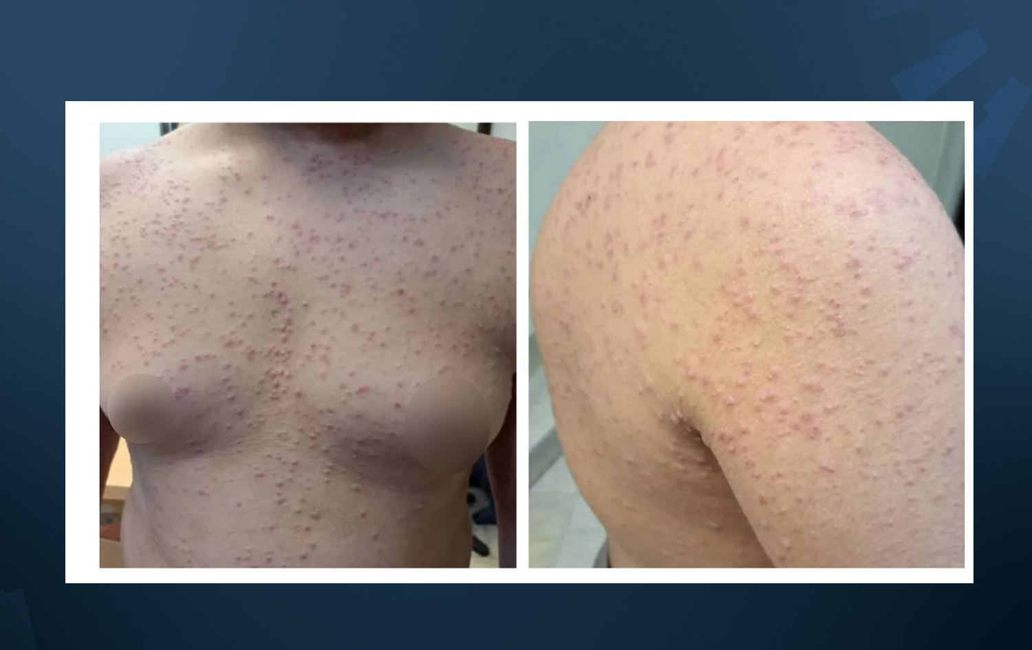 وێنەی تووشبووەکە کە میدیاکان دەڵێن، لە پەڕەی فەرمیی د. محەممەد رەزا یەزدان نیاز بڵاوکراوەتەوە