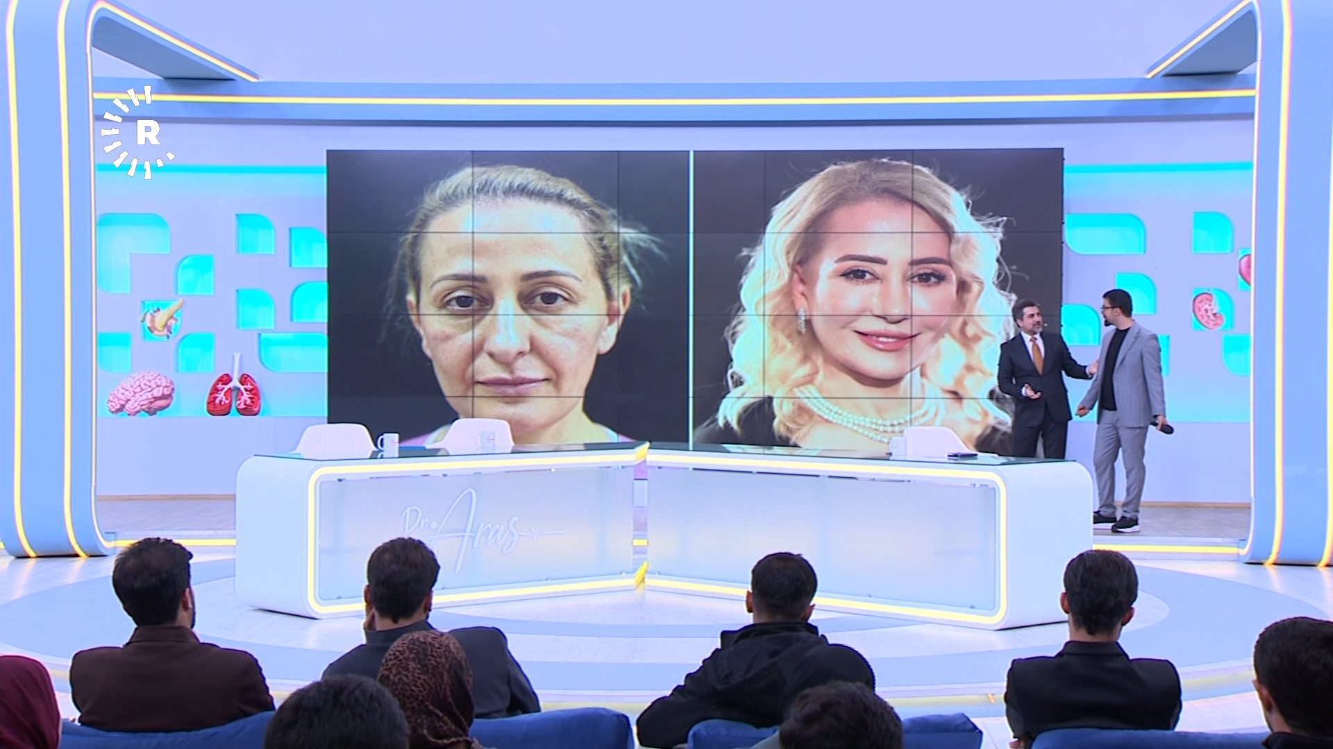 نەشتەرگەریی جوانکاریی تووندکردنەوە و راکێشانی رووخسار