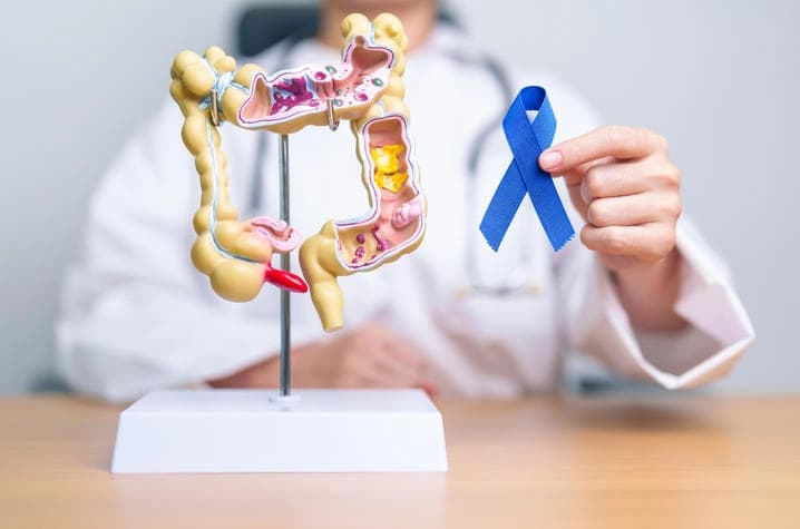توێژەرانی چین، ژاپۆن و ئیسپانیا پشکنینێکی نوێی شێرپەنجەی کۆڵۆن و رێکە دەدۆزنەوە