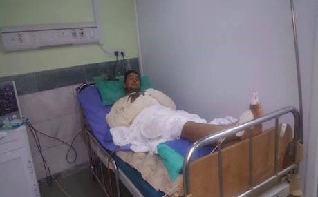 Six bullets: The miraculous escape of a Kurdish Peshmerga 