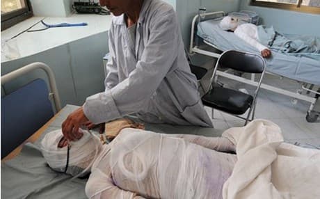ژنە ئاوارەیەك خۆی دەسووتێنێ