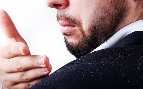 کڕێشی سەر لە ئەنجامی گەشەی نائاسایی خانەکانی پێستی سەر درووستدەبێت 