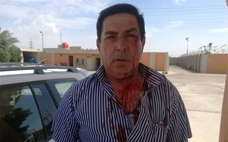 Irfan Saadullah says he was attacked by a rival candidate and up to 20 armed men. Photo: Rudaw