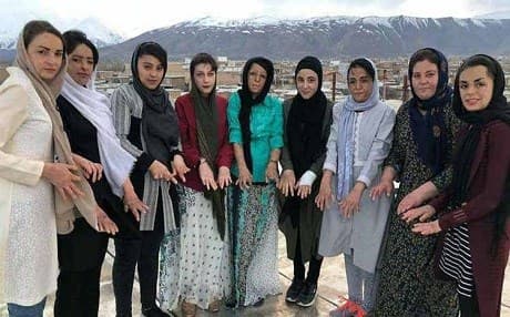 A photo posted on March 3, 2018 shows some of the scars of 9 of the 37 survivors of the Shinabad school fire. Photo: Iran HRM