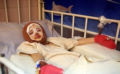 An injured teenager rests on a gurney at Mottahari hospital in the Iranian capital Tehran, March 19, 2019. Photo: Masoud Shahrestani / Tasnim 