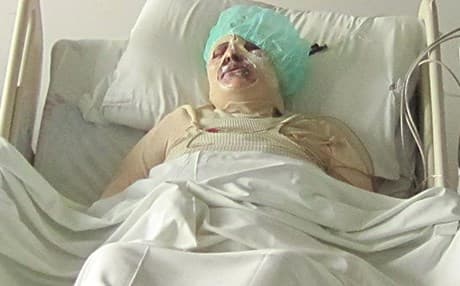 ژنێكی 49 ساڵان خۆی دەسووتێنێ‌