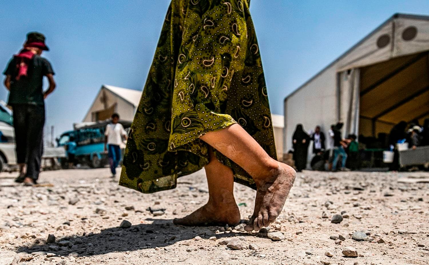 In this file photograph taken on July 22, 2019, a young child walks barefoot at al-Hol camp for displaced people, in al-Hasakeh governorate, north-eastern Syria. Photo: Delil Souleiman/ AFP