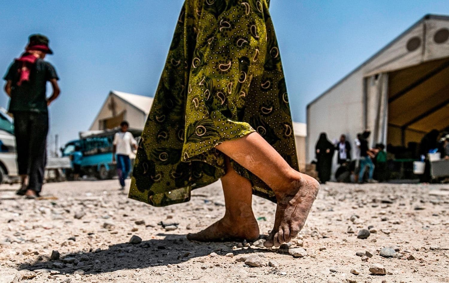 A young child walks barefoot at al-Hol camp on July 22, 2019. File photo: AFP