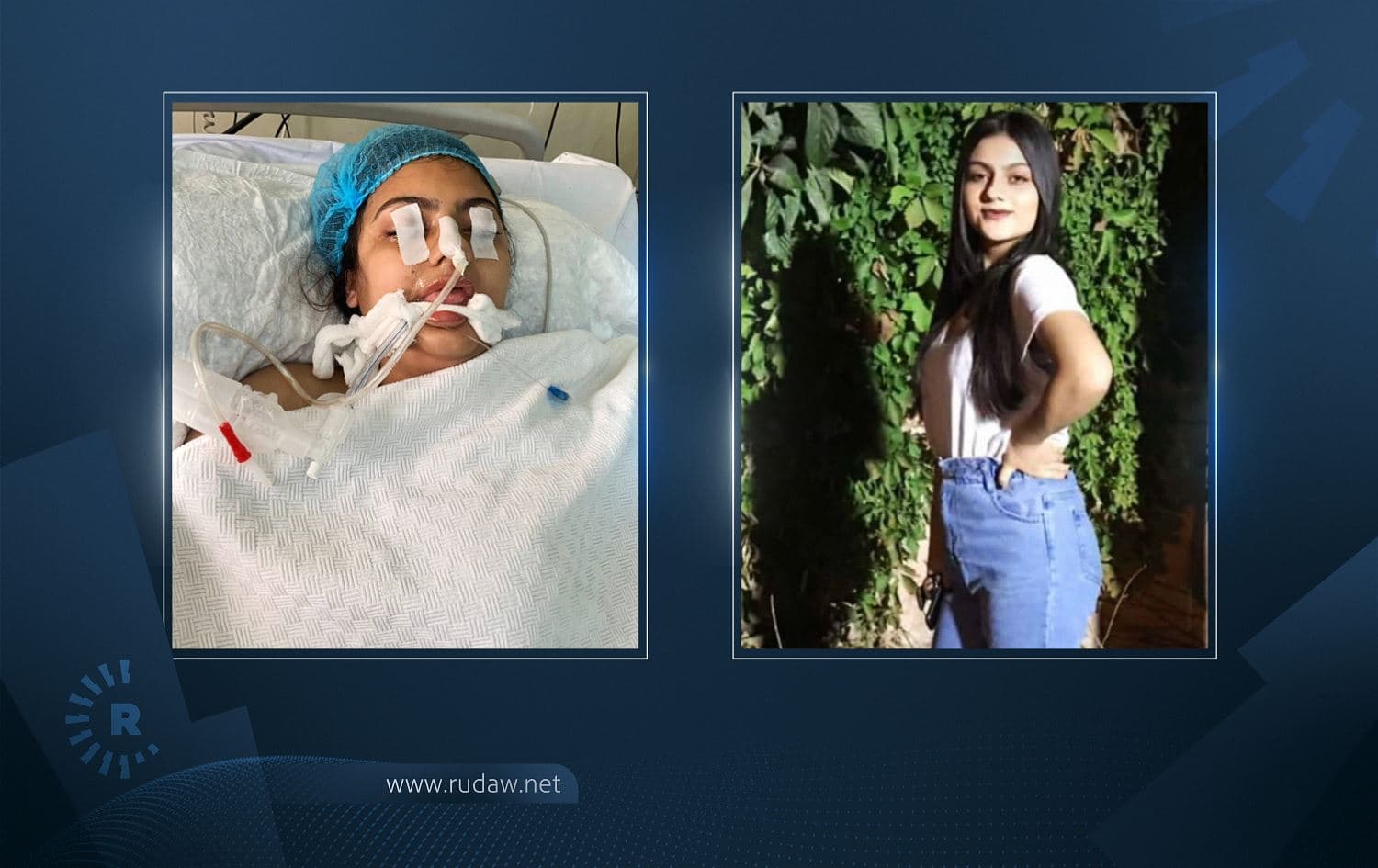 Ayjan after and before the incident. Photos submitted: by Ayjan's Family