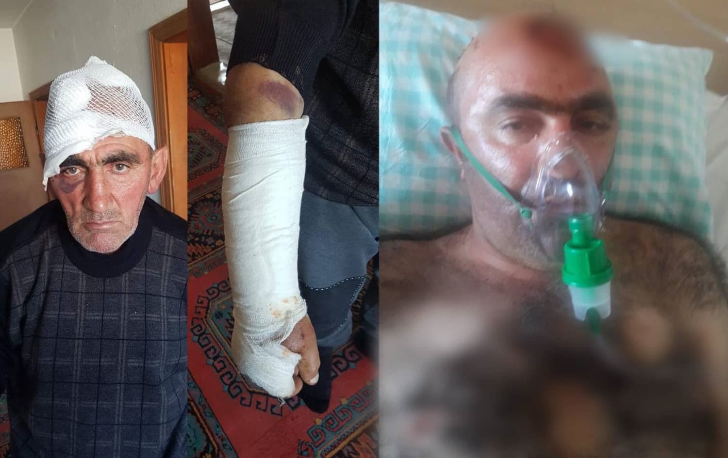 Ji malbata Kurd 7 kes birîndar bûn