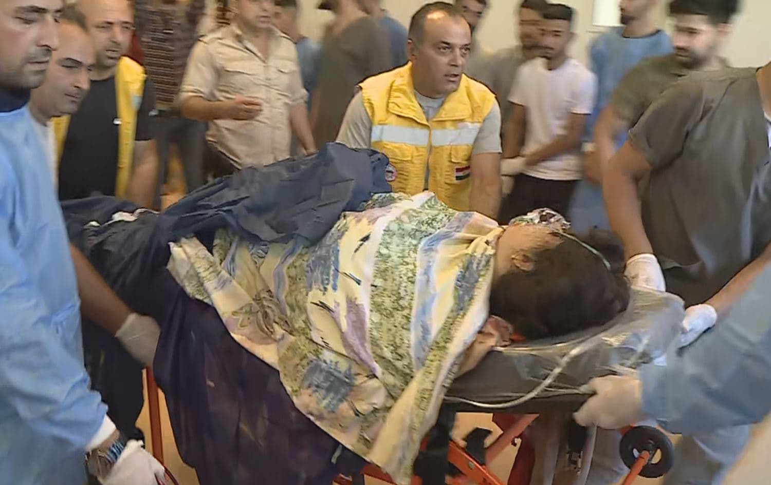 A woman injured by Turkey's bombardment that targeted touristic locations in Duhok on July 20, 2022. Photo: Rudaw