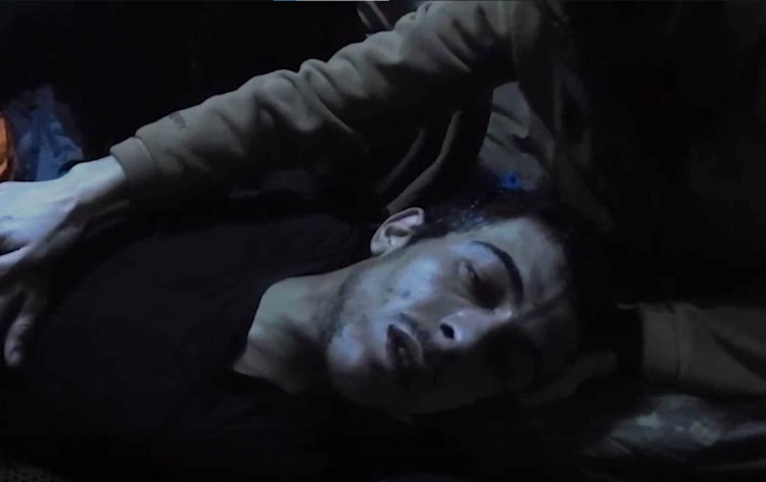 A PKK fighter who has been affected by alleged Turkish chemical attack in the Kurdistan Region recently. Photo: ANF 