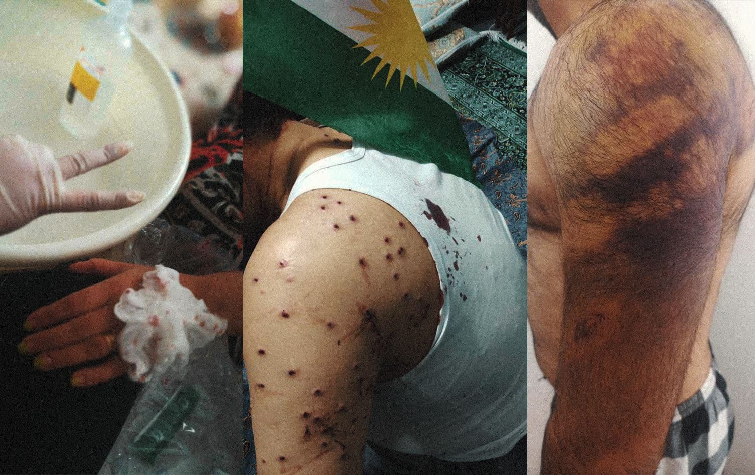 Kurdish doctor risks life to help wounded protesters in Iran