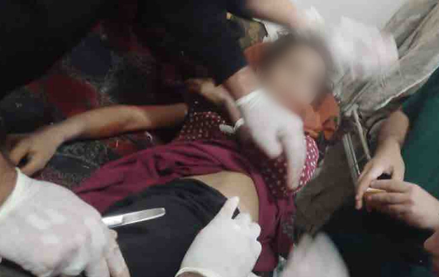A girl was injured as a result of Turkish bombardment in Rojava on October 9, 2023. Photo: SDF