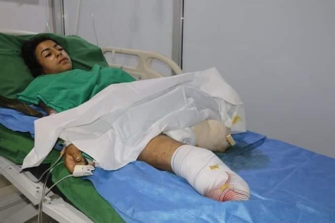 A civilian injured by a Turkish bombardment on Rojava on October 11, 2023. Photo: SDF 