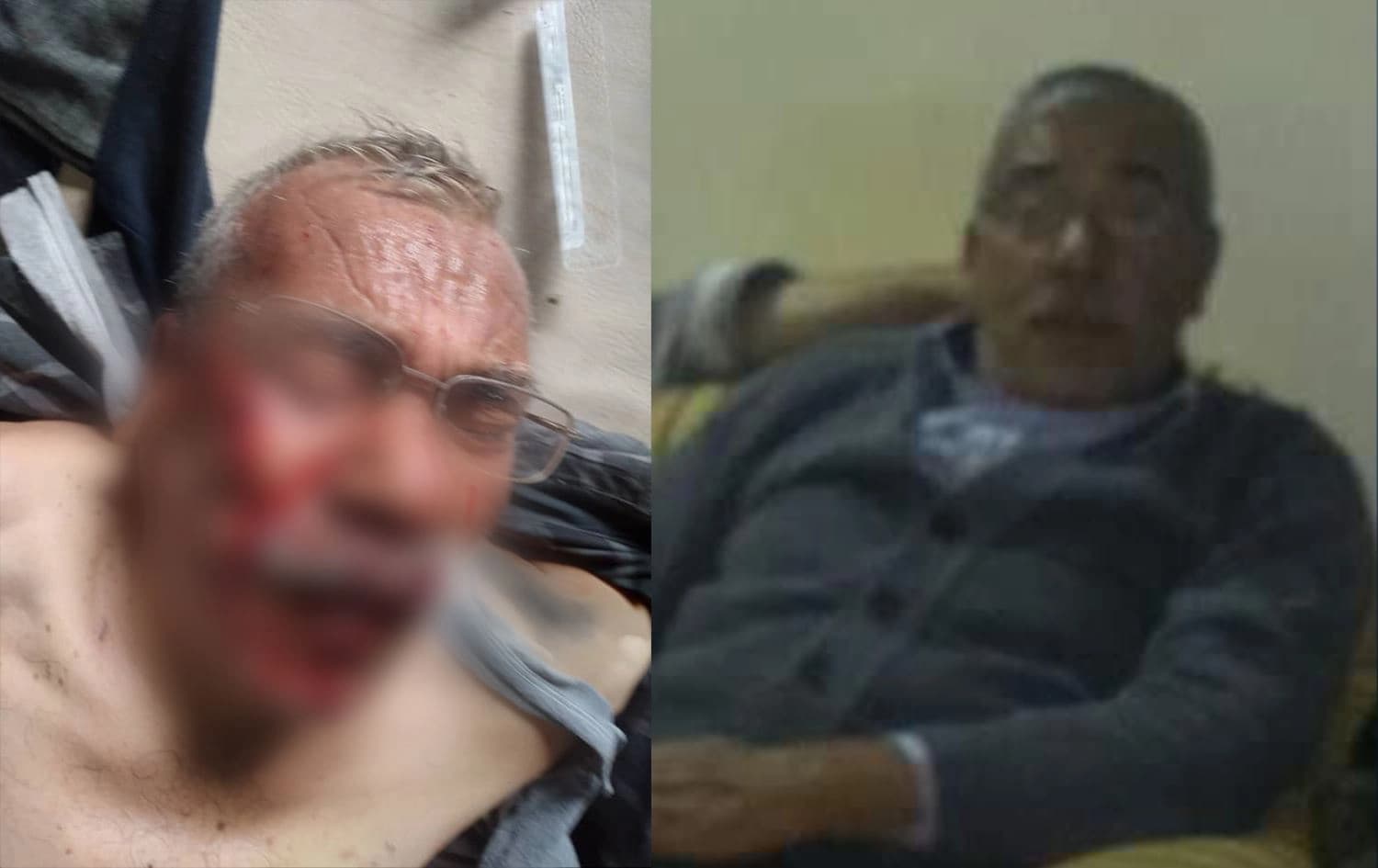 Kalemêrekî Kurd di êrişa Tirkiyeyê de birîndar bû