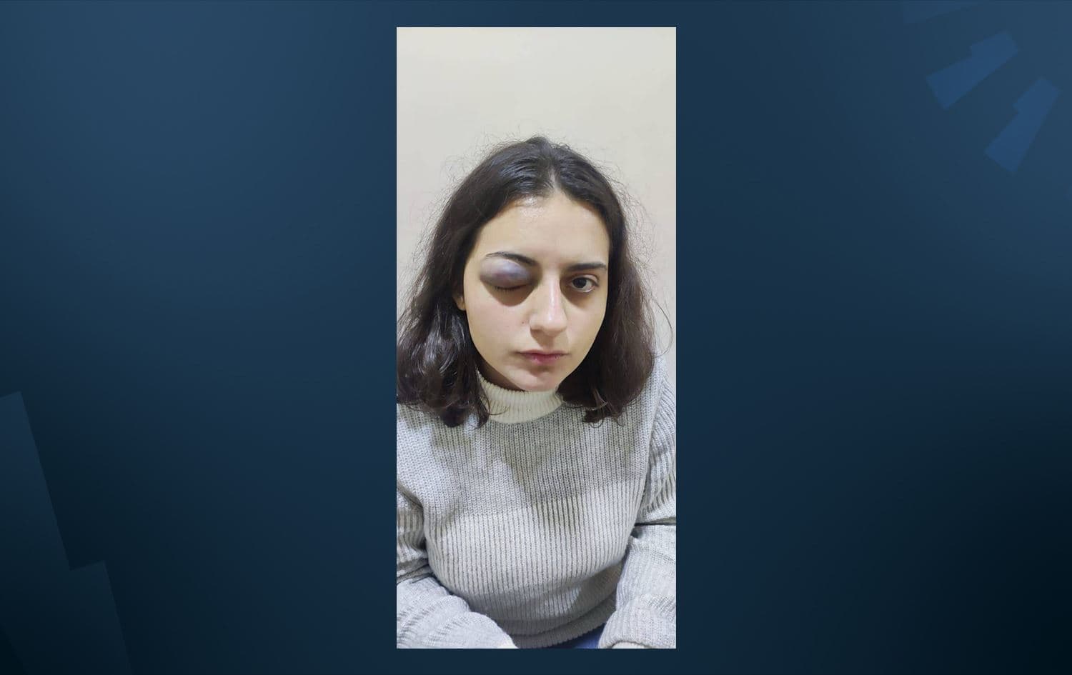 Berdevka Encûmena Ciwanan a HEDEPê Edanur Îbrahîmoglu /Wêne: HEDEP