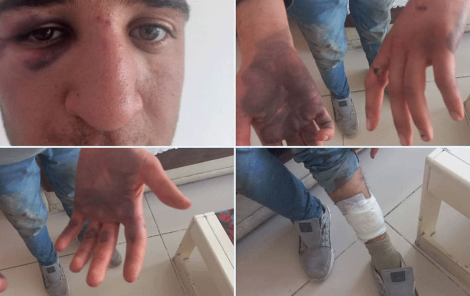 Şkence li Birîndar Gezîcî hatiye kirin / Wêne: Ajans