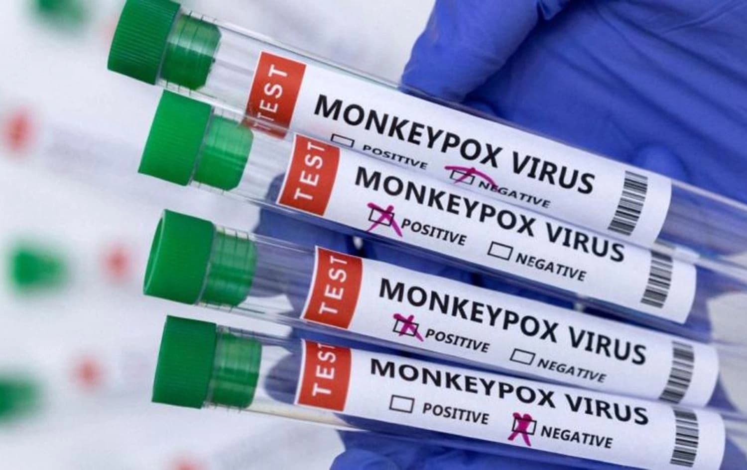 Test tubes for testing monkeypox infection. Photo: AP