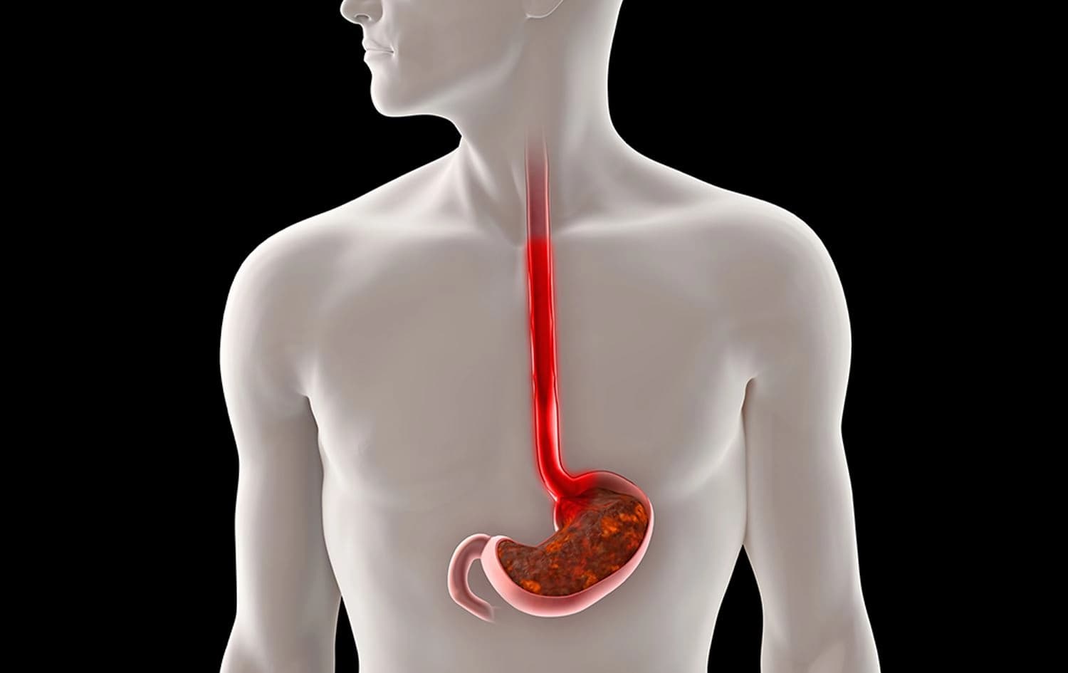 دڵەکزێ. وێنە: Descoveries in Medicine