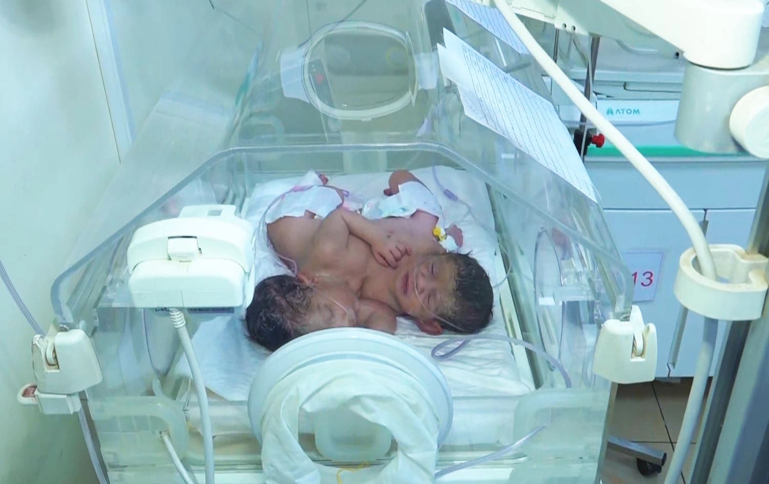 منداڵە دووانەکە. وێنە: رووداو