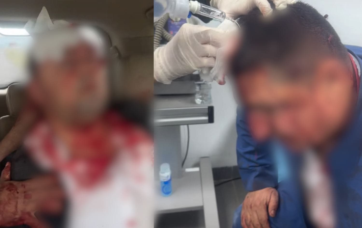 وێنەی دوو لەو کەسانەی لە شەڕەکەدا بریندار بوون