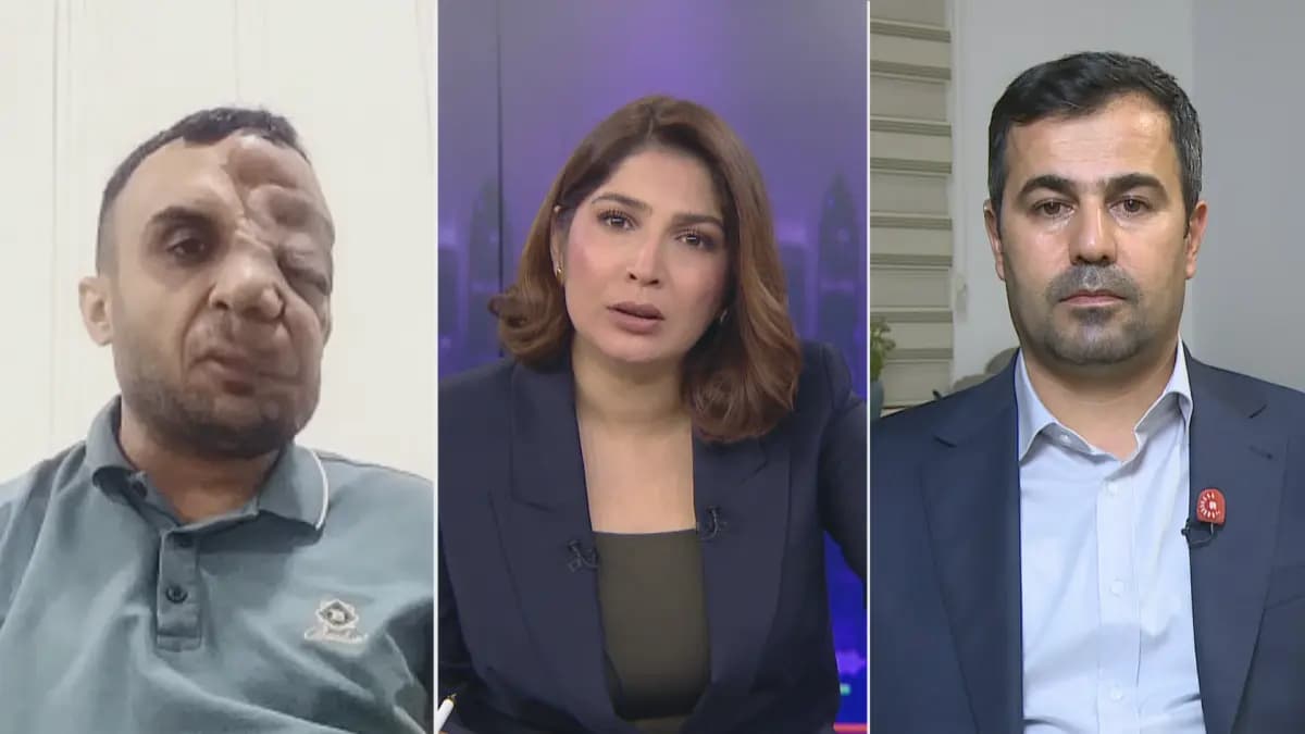 8 kez ameliyat oldu, hastalık yeniden yüzünü sardı: Miran hayat mücadelesi veriyor