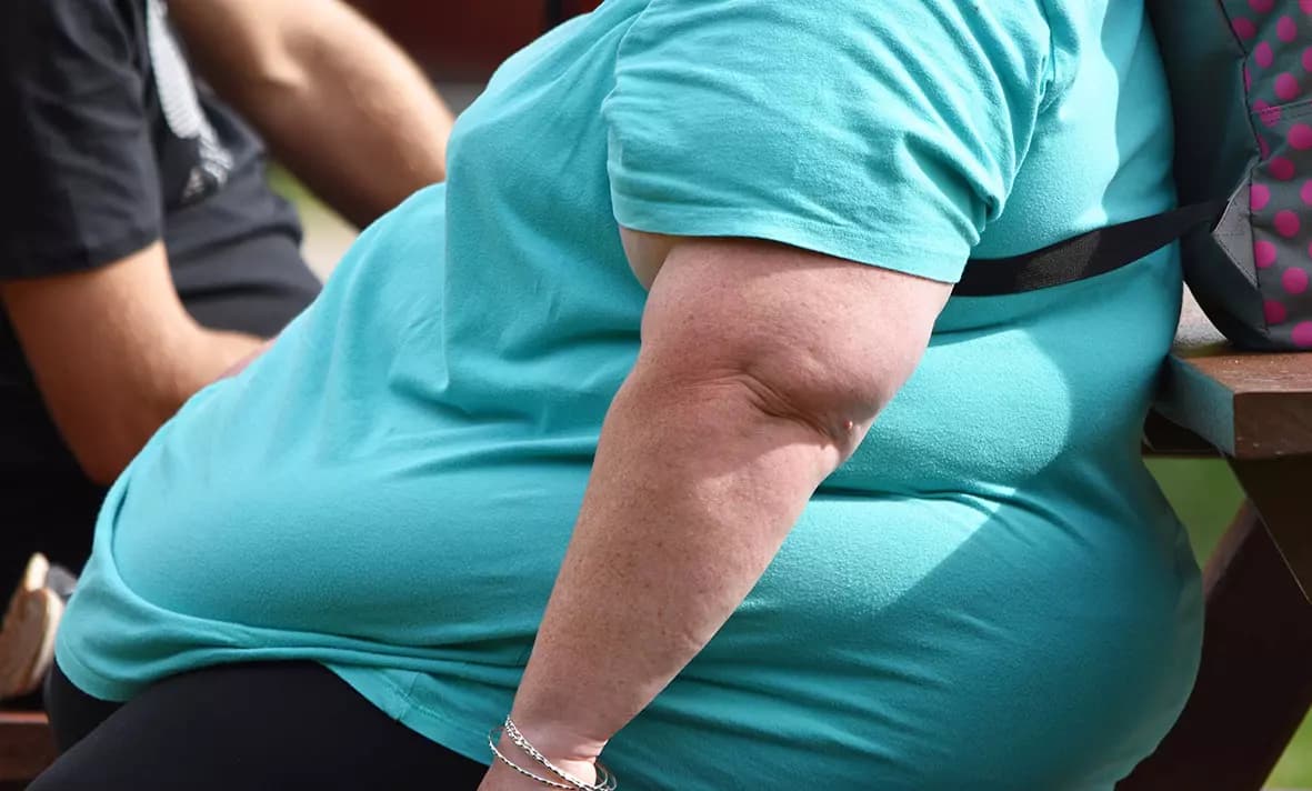 Uzmanından obezite uyarısı: Uyku apnesi riskini artırıyor, uyurken nefesiniz durabilir