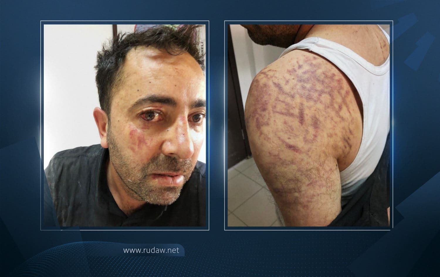 Iğdır Belediye Başkan Yardımcısı Halis Güney