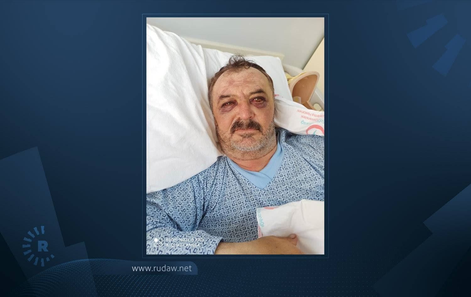 Osman Siban pictured in hospital. Photo: social media