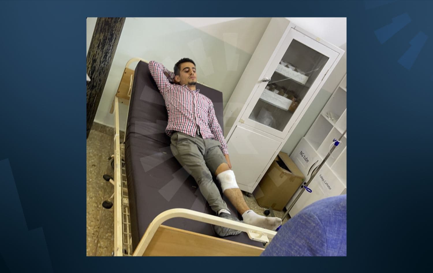 Bawar Ahmad was injured in a Turkish bombardment near his village of Deshish, northern Duhok on May 25, 2021. Photo: Rudaw