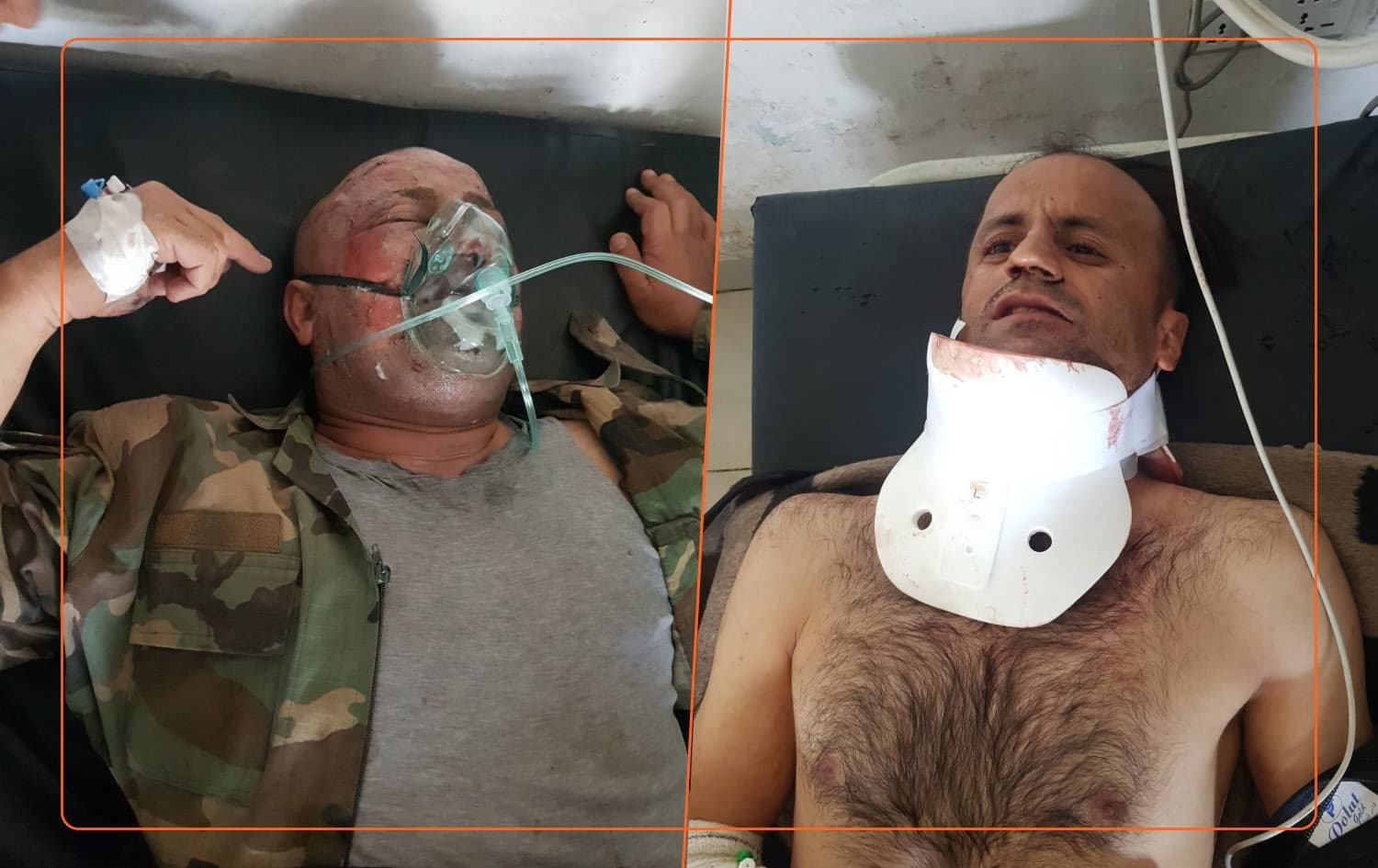 Two of the four Peshmerga injured in a PKK attack on Duhok's Metina mountain on June 5, 2021 are pictured in hospital in Duhok. Photo: Rudaw