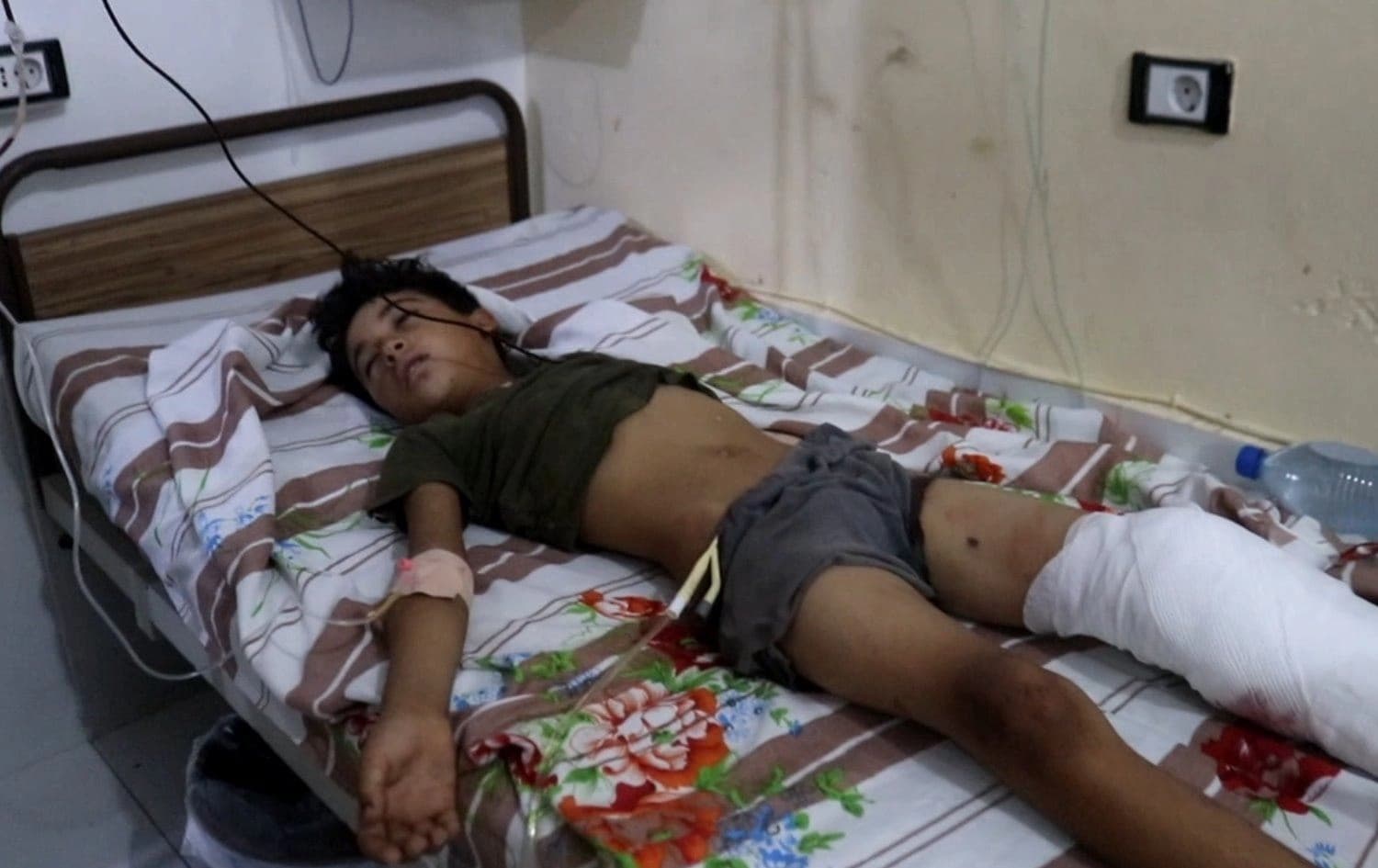A child was injured in Turkish bombardment near Manbij, Syria on August 28, 2021. Photo: handout/Manbij Military Council