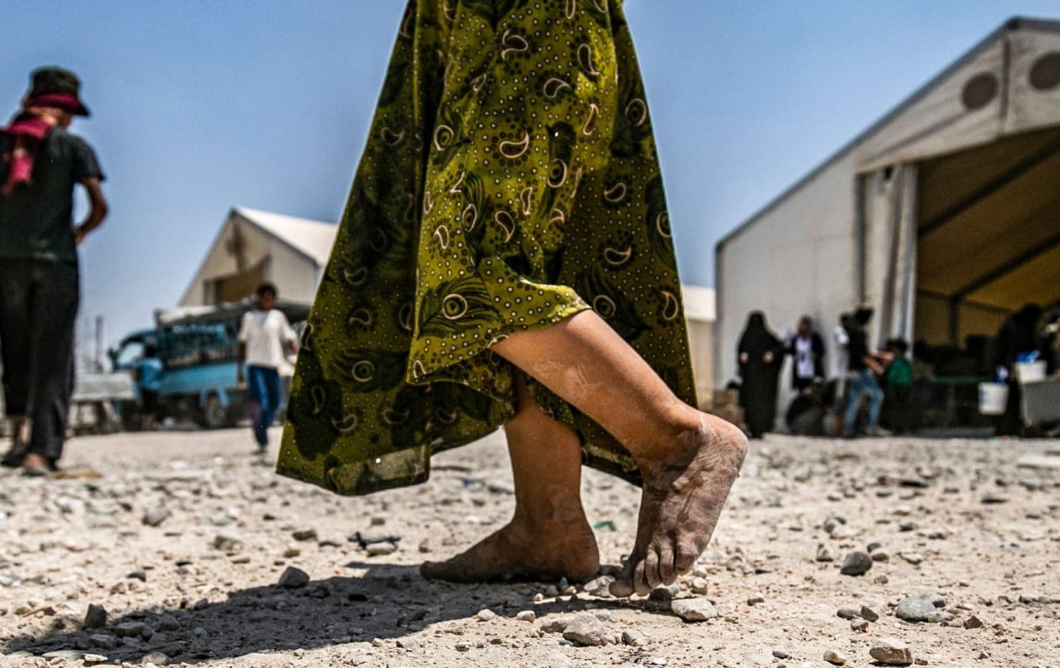 A young child walks barefoot at al-Hol camp in Hasaka, northeast Syria, on July 22, 2019. Photo: AFP