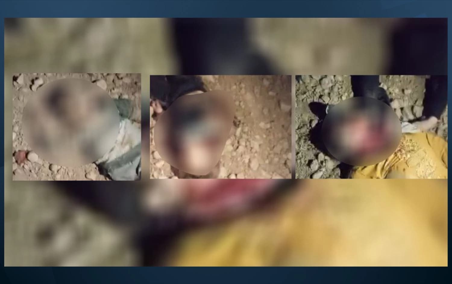 Kesên ku din bomberanê de cane xwe ji dest daye /Wêne: ANHA