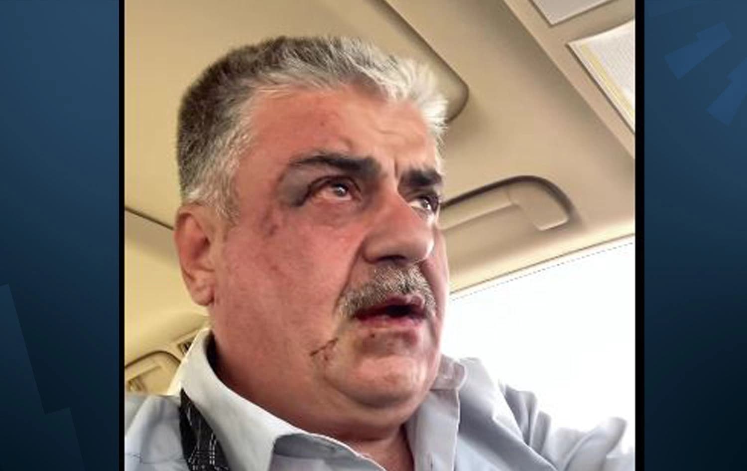 شوان سابیر، دوای ئەوەی هێرشی کرایە سەر.