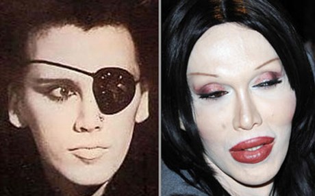 بەوێنە.. خراپترین نەشتەرگەری جوانکاری ئەستێرەکانی جیهان