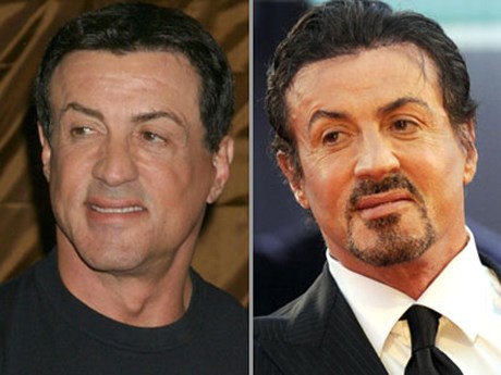 سیلفستەر ستالۆنی