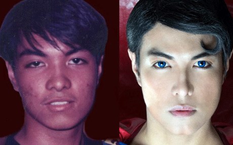 بەوێنە.. 23 نەشتەرگەری ئەنجامداوە تاوەكو بە سوپەرمان بچێت