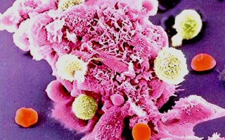 Sedemên penceşêrê çine?