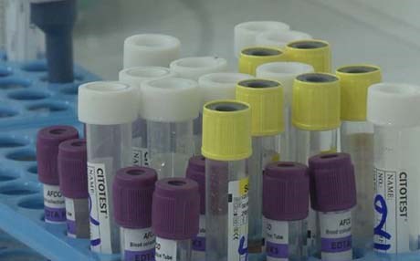 فرەنسا..تووشبووێکی ئایدز چاکبووەوە