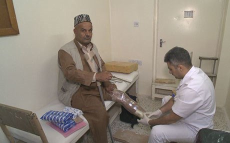 Erbil rehab center replaces limbs lost to landmines, disease