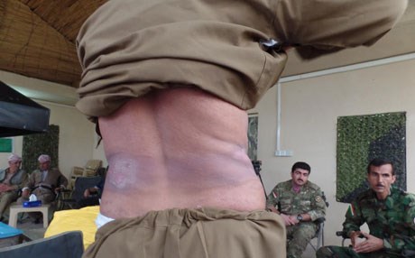 MSF gives Peshmerga anti-chemical weapons gear