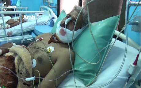 Civilians targeted by Houthi bombing in Taiz