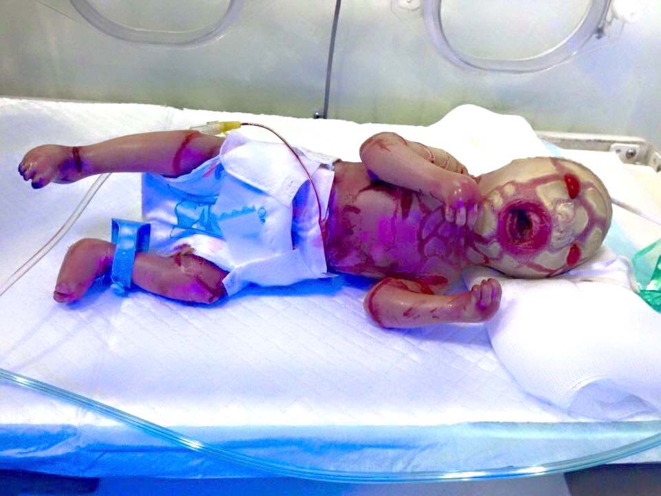 Duhok’ta balık bebekler