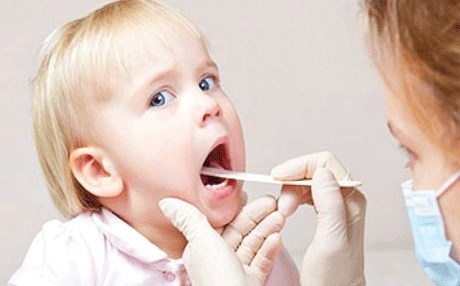 التهاب اللوزتين وطرق معالجتها عند الأطفال